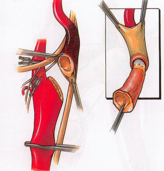 carot-kieffer-7